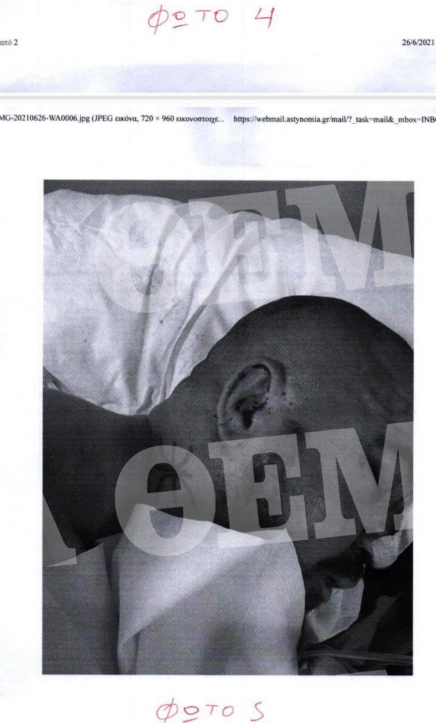 Μύκονος: Καρέ-καρέ ο άγριος ξυλοδαρμός του σωματοφύλακα του Νταν Μπιλζέριαν - Του χτυπούσαν το κεφάλι στον τοίχο