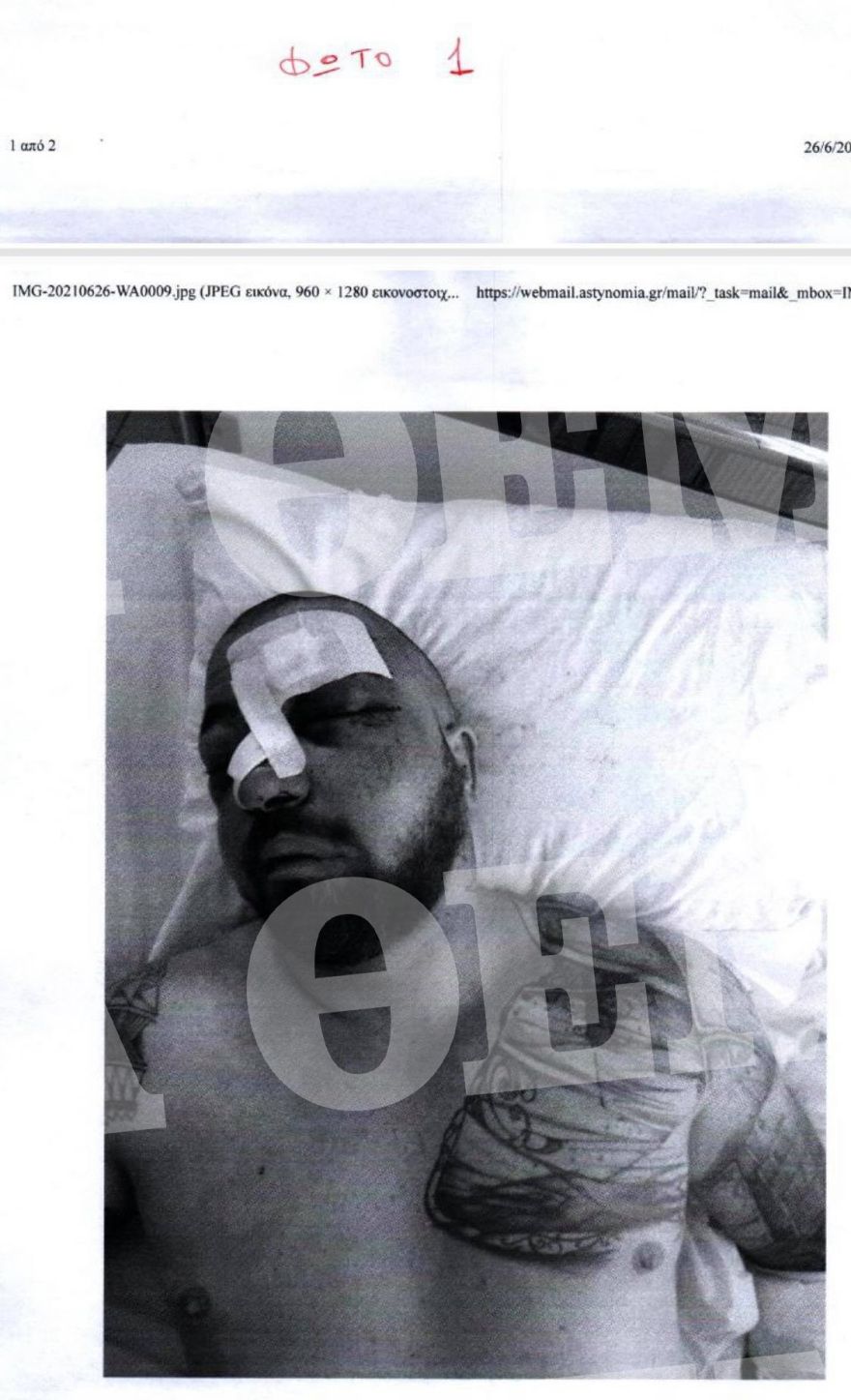 Μύκονος: Καρέ-καρέ ο άγριος ξυλοδαρμός του σωματοφύλακα του Νταν Μπιλζέριαν - Του χτυπούσαν το κεφάλι στον τοίχο