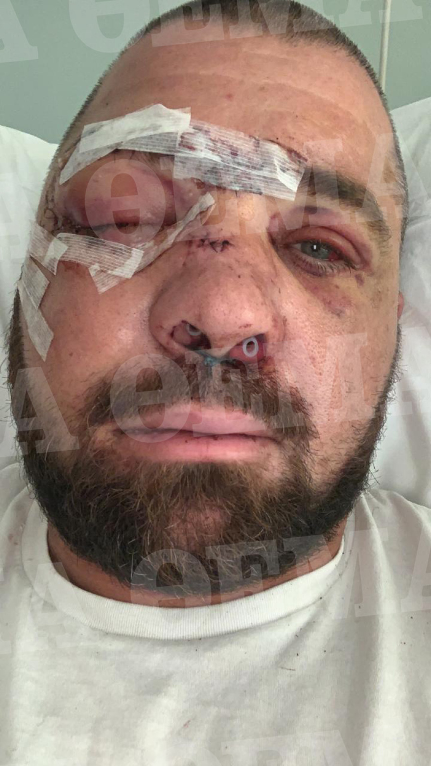 Ο σωματοφύλακας του Νταν Μπιλζέριαν για τον ξυλοδαρμό του στη Μύκονο: «Θα μπορούσαν να με έχουν σκοτώσει, τραγικό που τους άφησαν ελεύθερους»