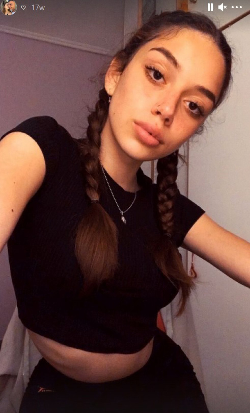 Τροχαίο στην Κεφαλονιά: Από βαριές κρανιοεγκεφαλικές κακώσεις ο θάνατος των δύο νεαρών παιδιών