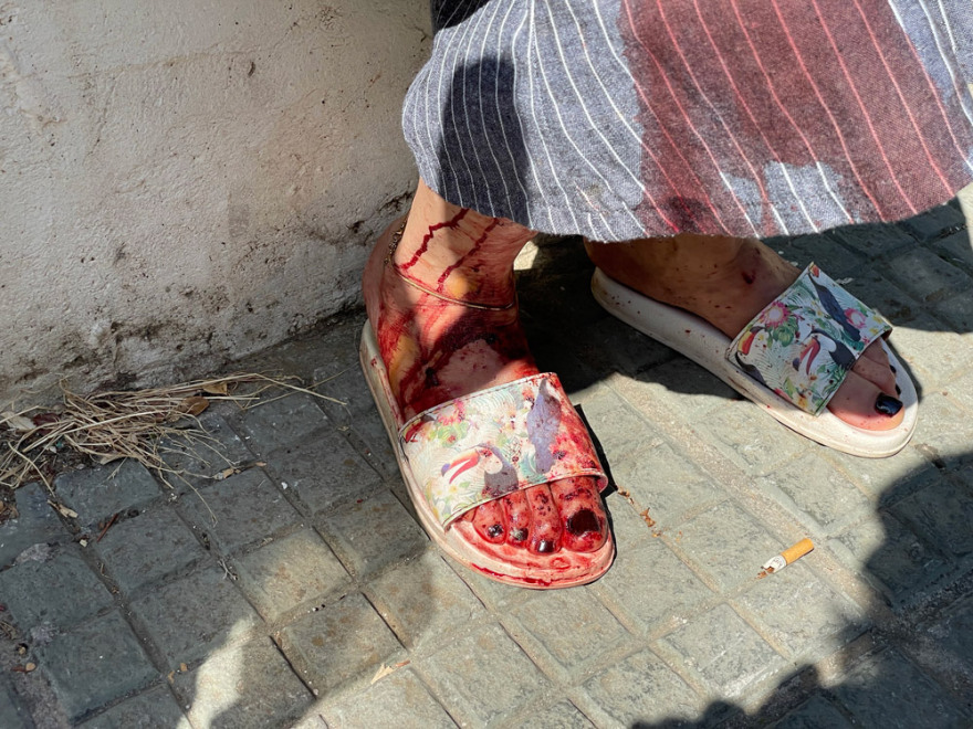 Επίθεση με μαχαίρι στου Ζωγράφου: «Ελάτε, έχω μαχαιρώσει κόσμο», φώναζε ο 54χρονος που το είχε «σκάσει» από το Δαφνί