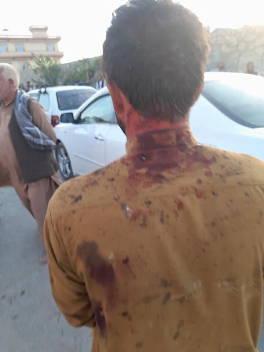 Αφγανιστάν: Πανικός μετά τις εκρήξεις στο αεροδρόμιο της Καμπούλ - Για χτύπημα του ISIS μιλούν οι Αμερικανοί - Δείτε βίντεο και φωτογραφίες