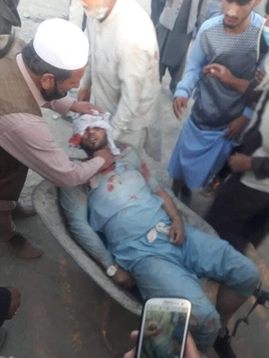 Αφγανιστάν: Πανικός μετά τις εκρήξεις στο αεροδρόμιο της Καμπούλ - Για χτύπημα του ISIS μιλούν οι Αμερικανοί - Δείτε βίντεο και φωτογραφίες