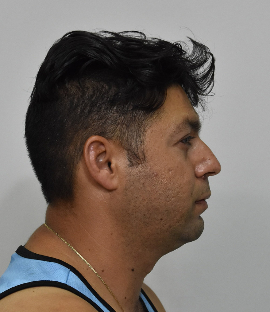 Μαρκόπουλο: Αυτοί είναι οι δύο διαρρήκτες που «ρήμαζαν» σπίτια