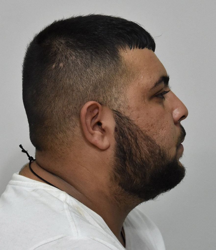 Μαρκόπουλο: Αυτοί είναι οι δύο διαρρήκτες που «ρήμαζαν» σπίτια