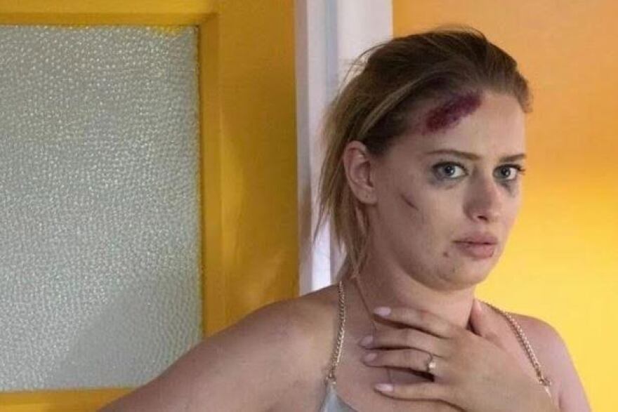 Ντόρα Μακρυγιάννη: Ξεσπά κατά των fake news - «Θα προσπαθήσω πολύ να συγκρατηθώ, είστε το λιγότερο γελοίοι»