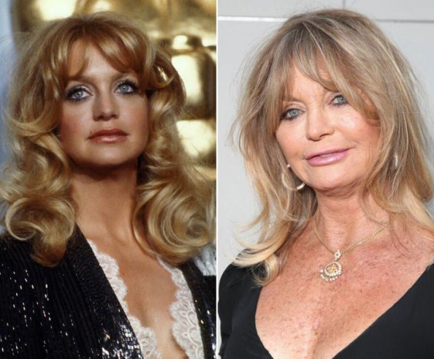 Ποιες διάσημες παραμορφώθηκαν μετά από πλαστικές επεμβάσεις