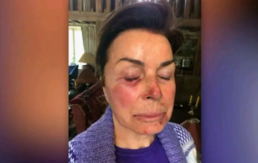 Ο Μπερνάρ Ταπί έγινε άγαλμα  στο «Βελοντρόμ» - Η μυθιστορηματική ζωή του προέδρου που οδήγησε την Μαρσέιγ στην κορυφή της Ευρώπης 