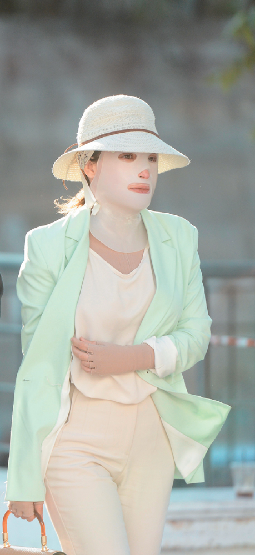 Επίθεση με βιτριόλι: «Ιωάννα, εσύ ξέρεις...» - Ποιο «μυστικό» θέλει να φορτώσει στο θύμα της η βιτριολίστρια;