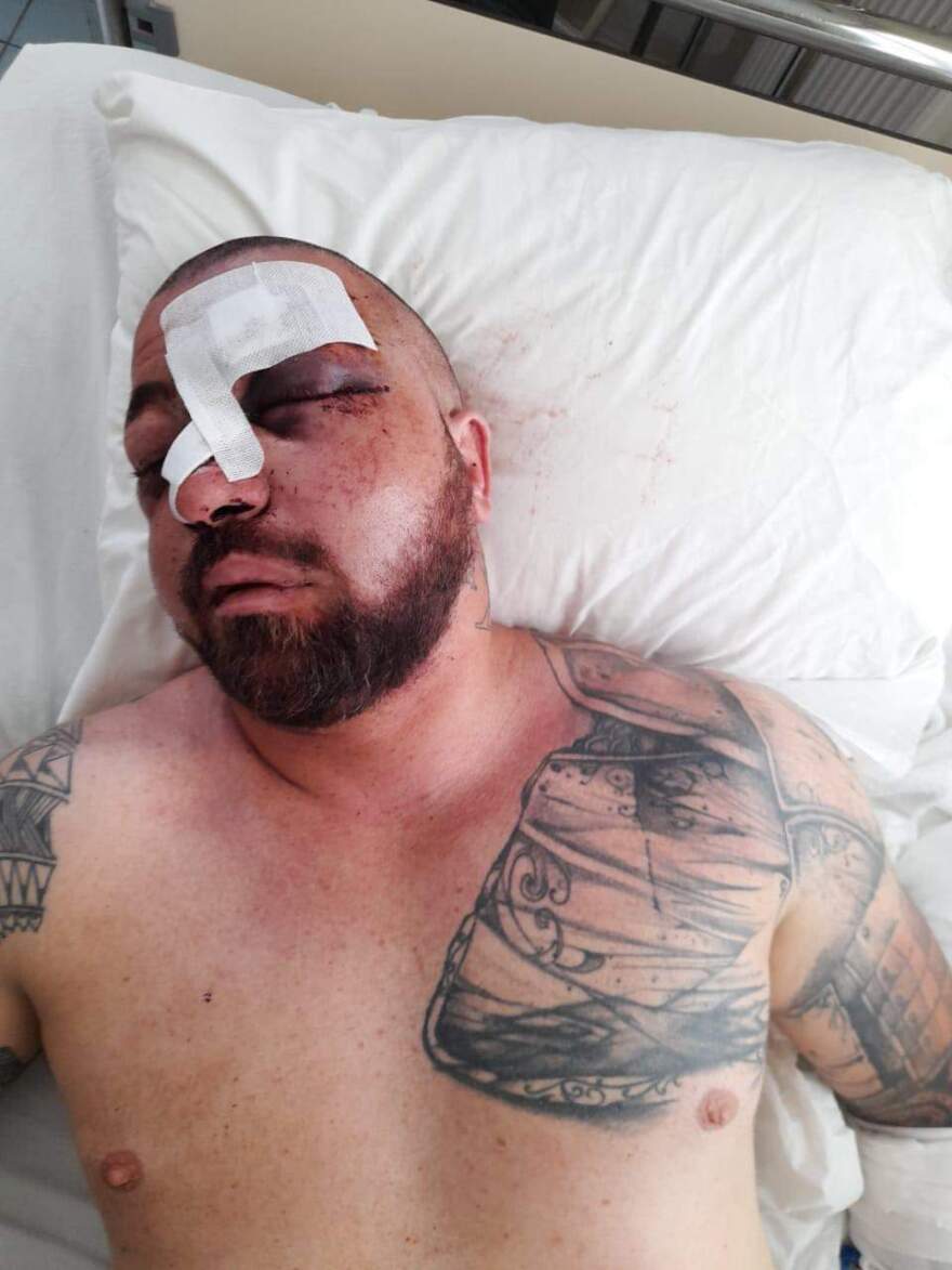 Η επιστροφή του σωματοφύλακα που ξυλοκοπήθηκε άγρια απο 15 άτομα στη Μύκονο - Δείτε φωτογραφίες