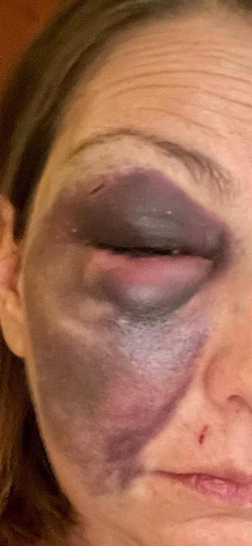 Στεφανία Τζαφέρη: Νέες σοκαριστικές φωτογραφίες στο Twitter από την άγρια κακοποίηση της blogger