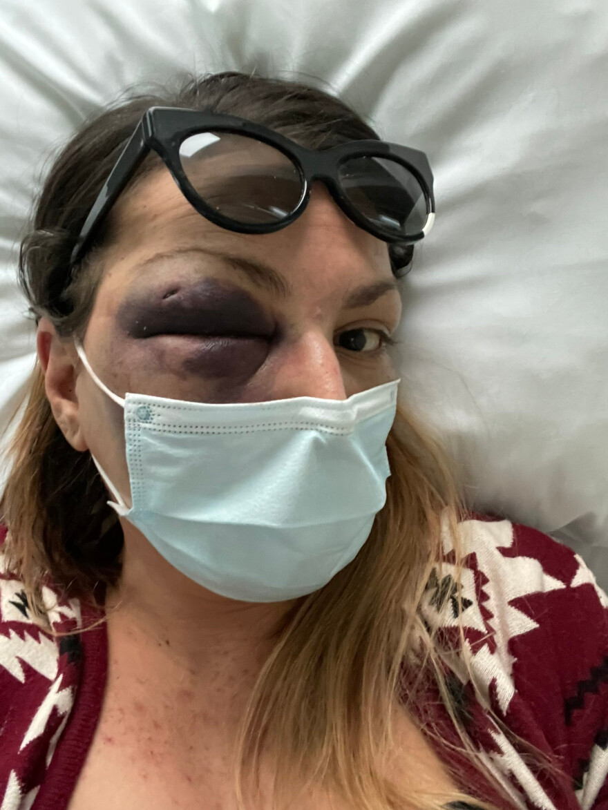 Στεφανία Τζαφέρη: Νέες σοκαριστικές φωτογραφίες στο Twitter από την άγρια κακοποίηση της blogger