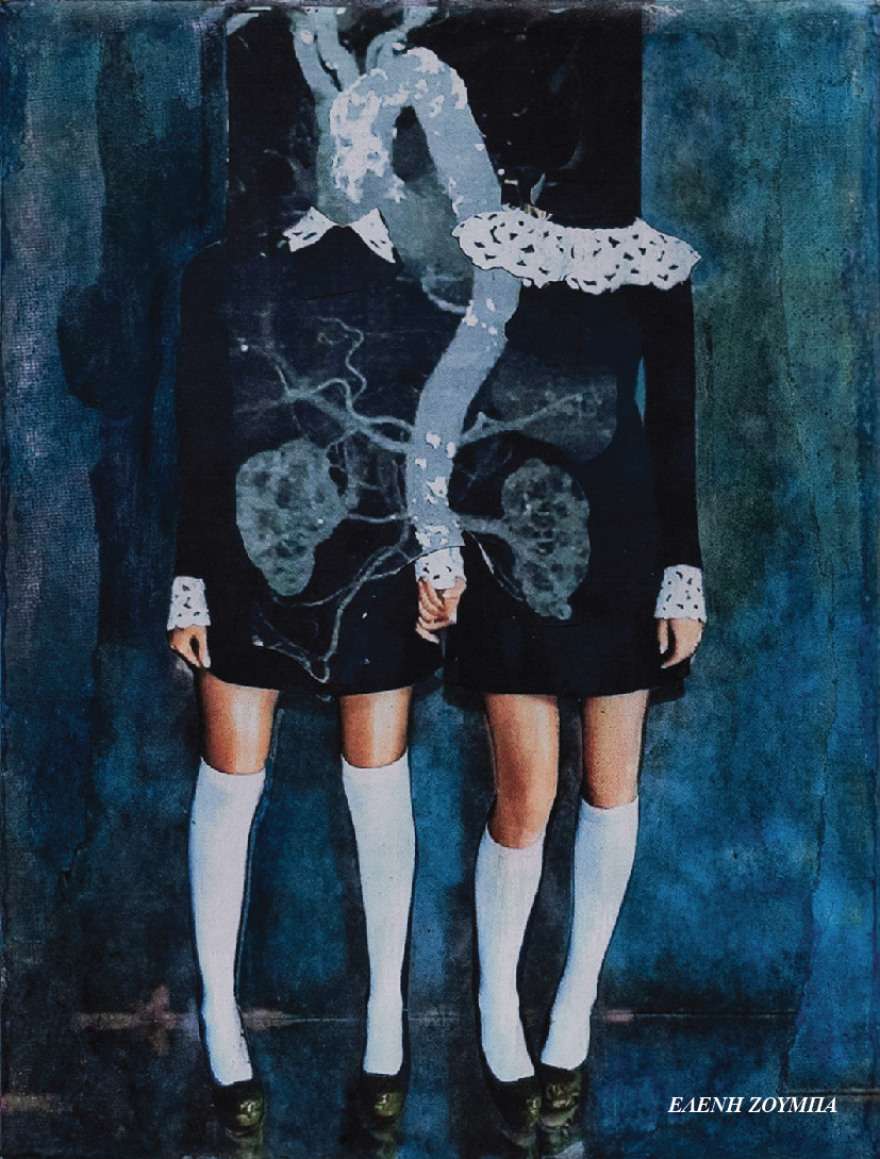 Η Χρόνια Νεφρική Νόσος μέσα από τα μάτια νέων καλλιτεχνών