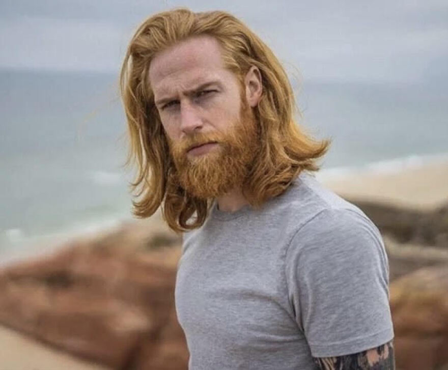 Γκουίλιαμ Πιου: Το «ασχημόπαπο» που κατέκτησε τις πασαρέλες έχει... κόκκινα γένια και κάποτε ζύγιζε 140 κιλά!