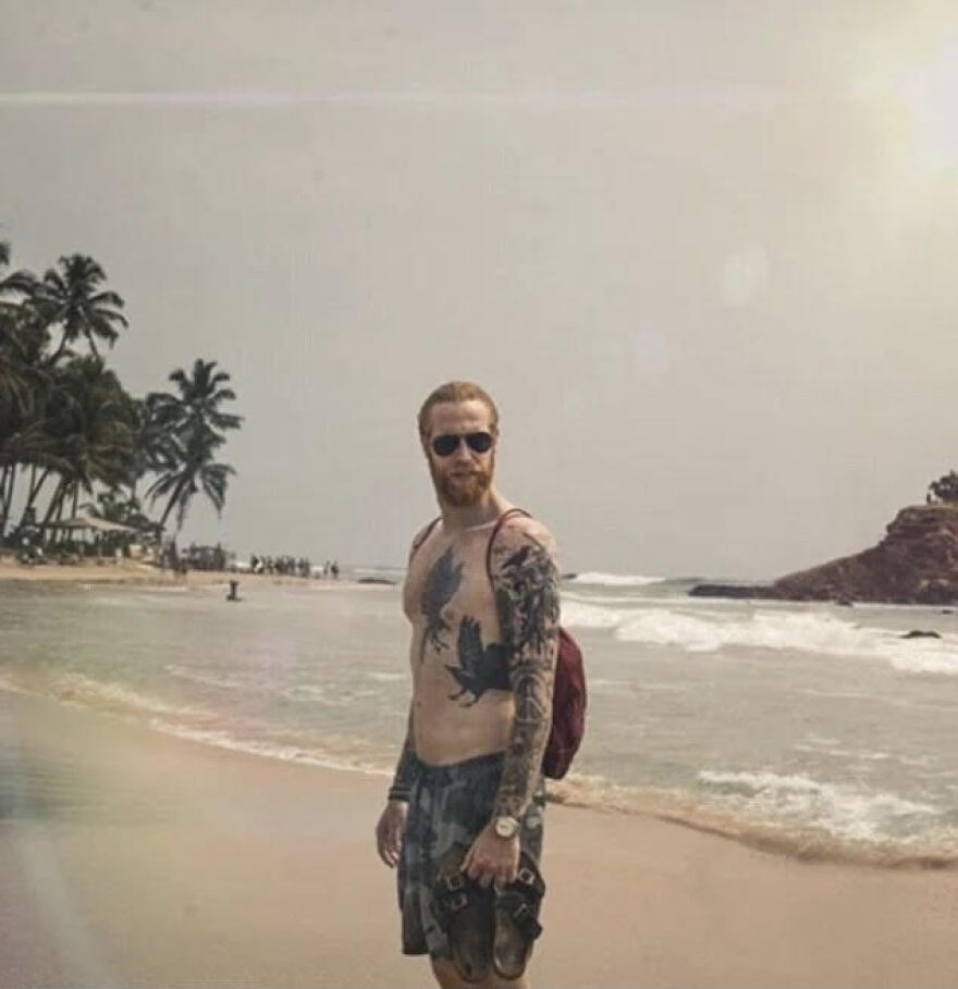 Γκουίλιαμ Πιου: Το «ασχημόπαπο» που κατέκτησε τις πασαρέλες έχει... κόκκινα γένια και κάποτε ζύγιζε 140 κιλά!