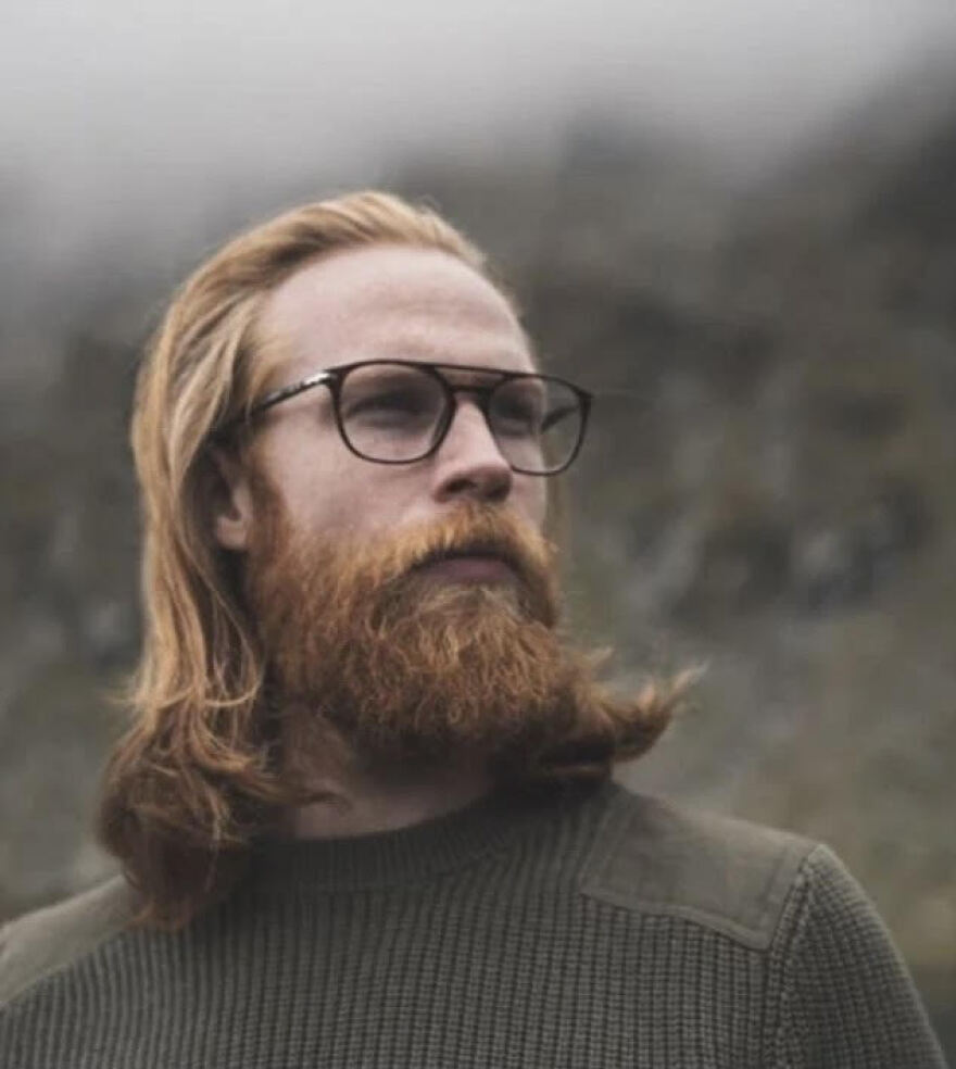 Γκουίλιαμ Πιου: Το «ασχημόπαπο» που κατέκτησε τις πασαρέλες έχει... κόκκινα γένια και κάποτε ζύγιζε 140 κιλά!