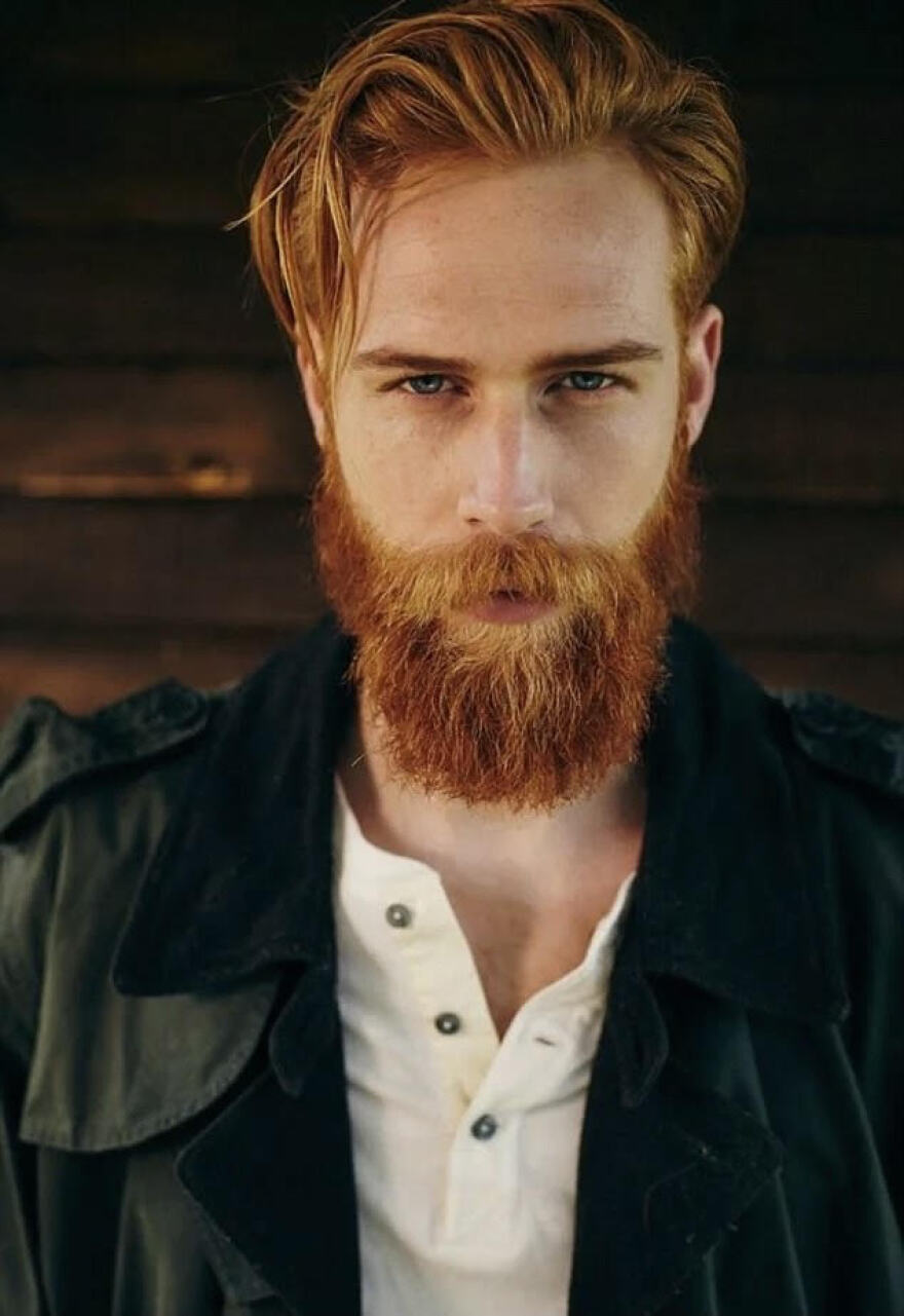 Γκουίλιαμ Πιου: Το «ασχημόπαπο» που κατέκτησε τις πασαρέλες έχει... κόκκινα γένια και κάποτε ζύγιζε 140 κιλά!