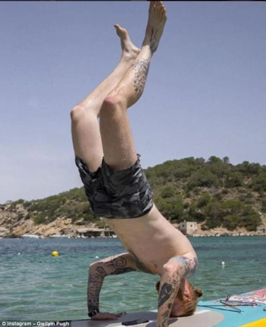 Γκουίλιαμ Πιου: Το «ασχημόπαπο» που κατέκτησε τις πασαρέλες έχει... κόκκινα γένια και κάποτε ζύγιζε 140 κιλά!