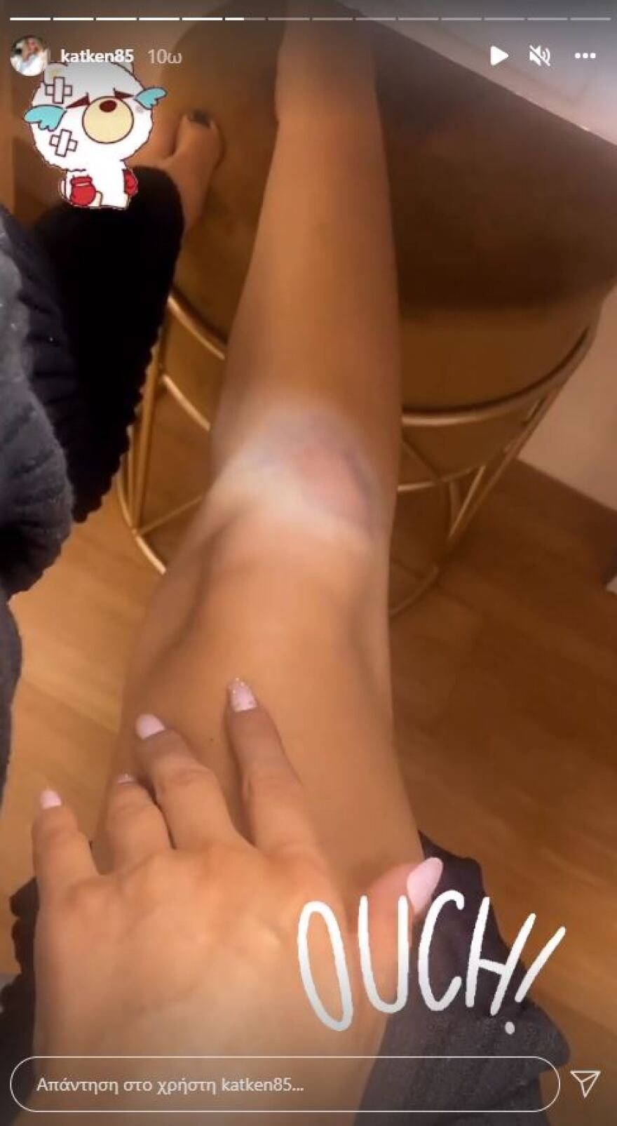 Ατύχημα είχε η Κατερίνα Καινούργιου – «Έπεσα, διαλύθηκα, το πόδι έχει γίνει τούμπανο»