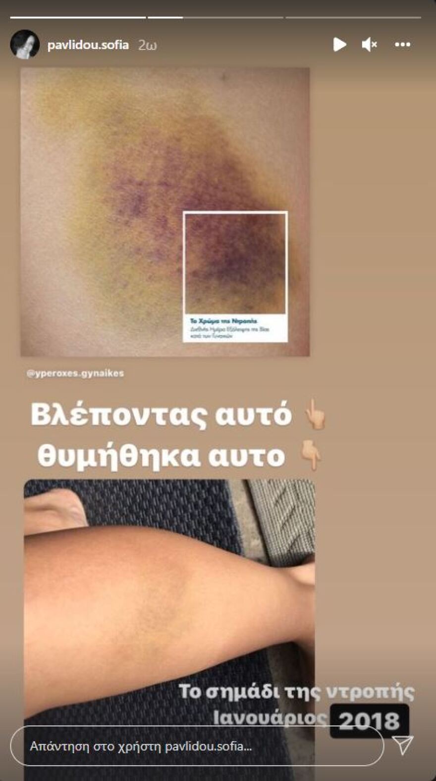 Η φωτογραφία της Σοφίας Παυλίδου μετά την κακοποίησή της από τον Μάνο Παπαγιάννη 