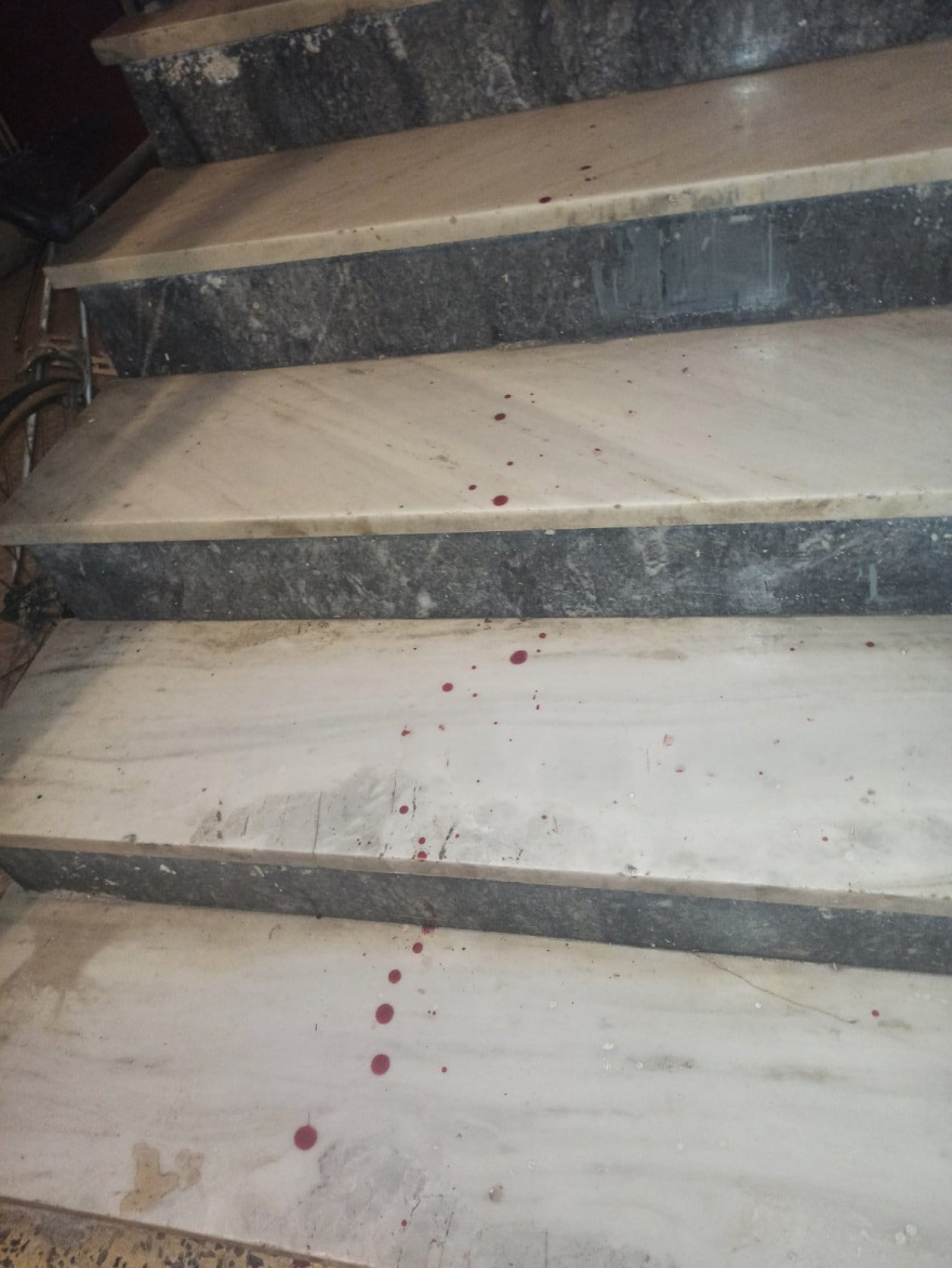 Θρίλερ στο Μενίδι: Βίντεο – ντοκουμέντο με τον άντρα που απειλούσε να σκοτώσει τη μητέρα του και μαχαίρωσε αστυνομικό 