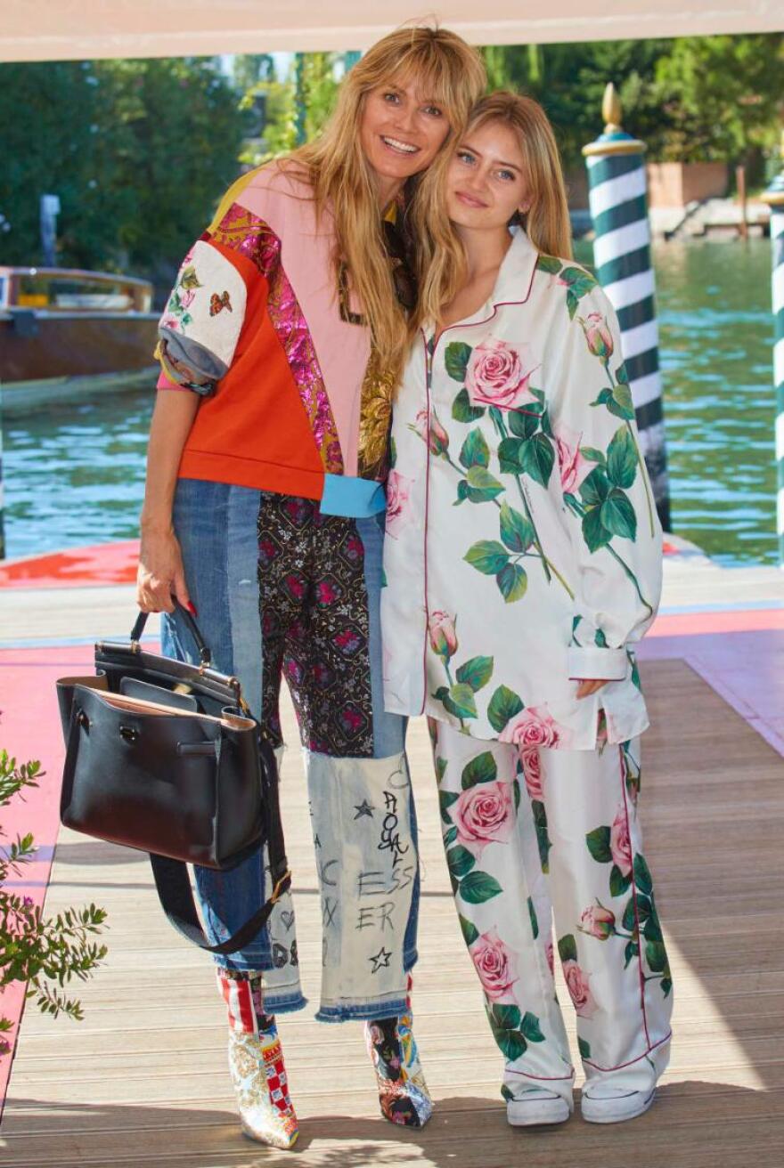 Λένι Κλουμ: Η κόρη ποζάρει στα 17 της και θυμίζει τη διάσημη μητέρα της