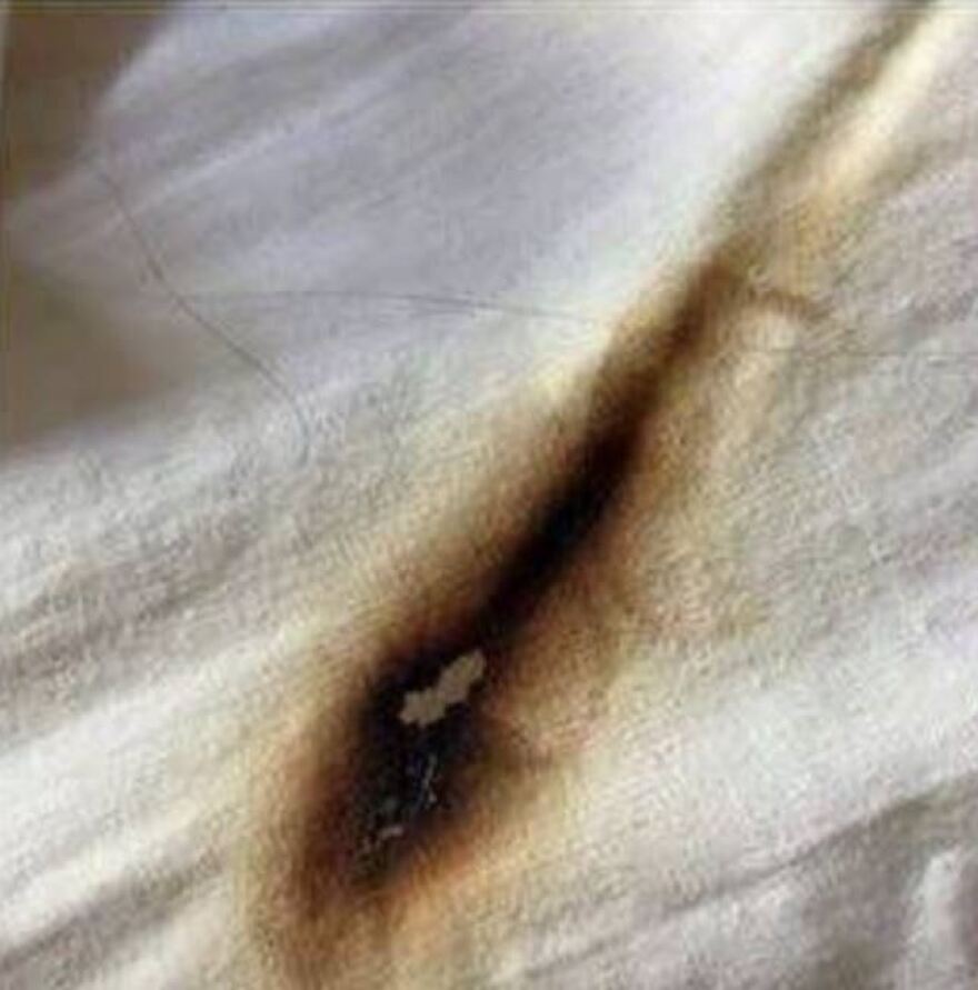 Να γιατί δεν πρέπει να φορτίζουμε το κινητό στο κρεβάτι!