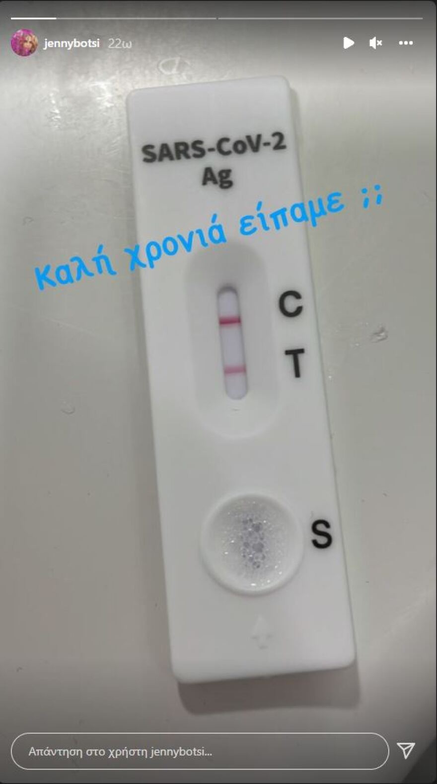 Θετική στον κορωνοϊό η Τζένη Μπότση