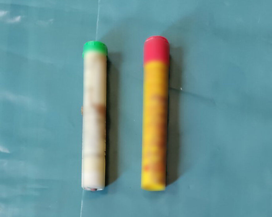 Μηνύματα σπαραγμού από τους συγγενείς του 19χρονου Άλκη, «του έδωσαν τη χαριστική βολή, τέτοια τομή μόνο χειρουργός»