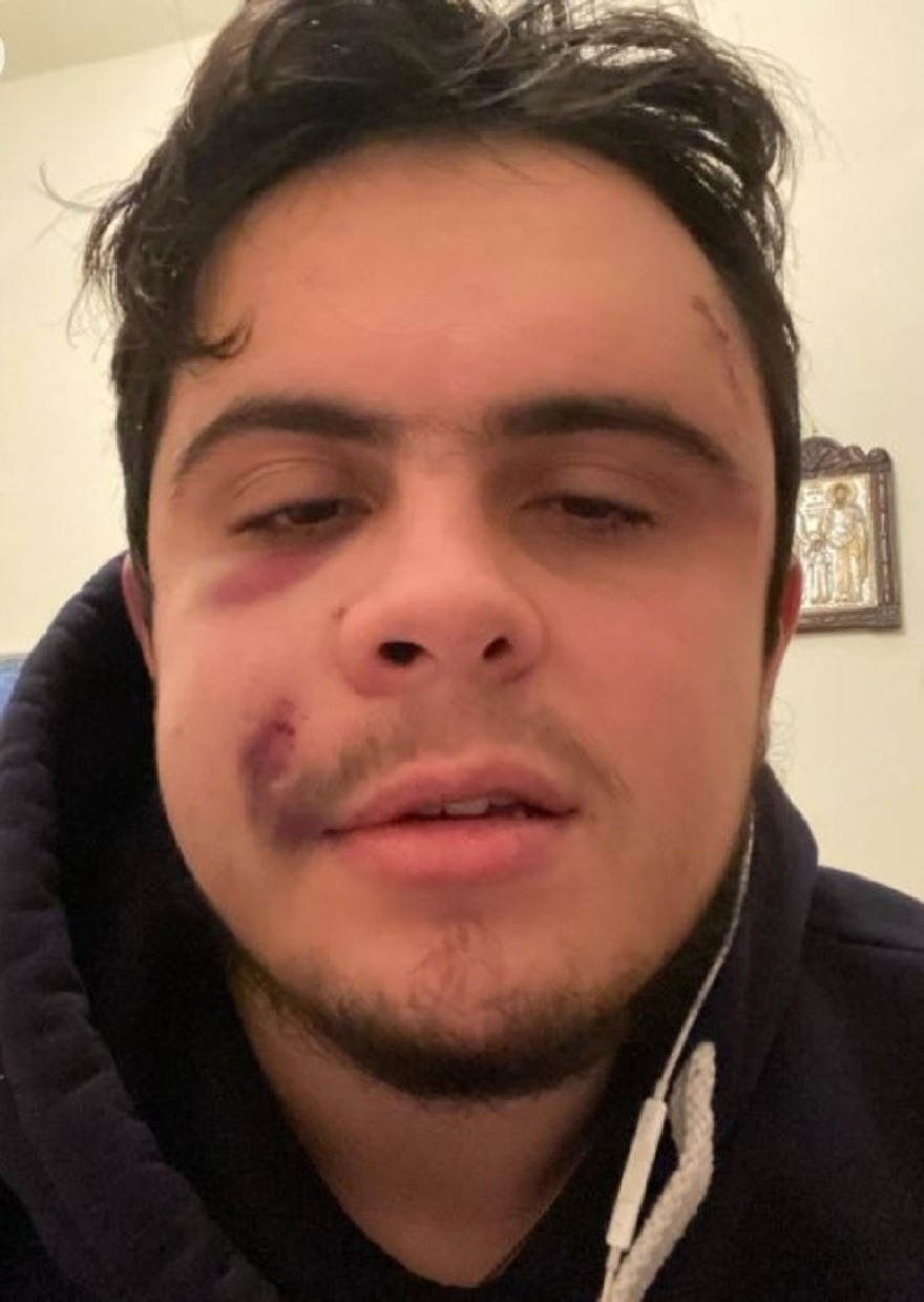 Οπαδική βία: Νέα καταγγελία στα Χανιά - «Αυτό που με χωρίζει από τον Άλκη, είναι η τύχη»