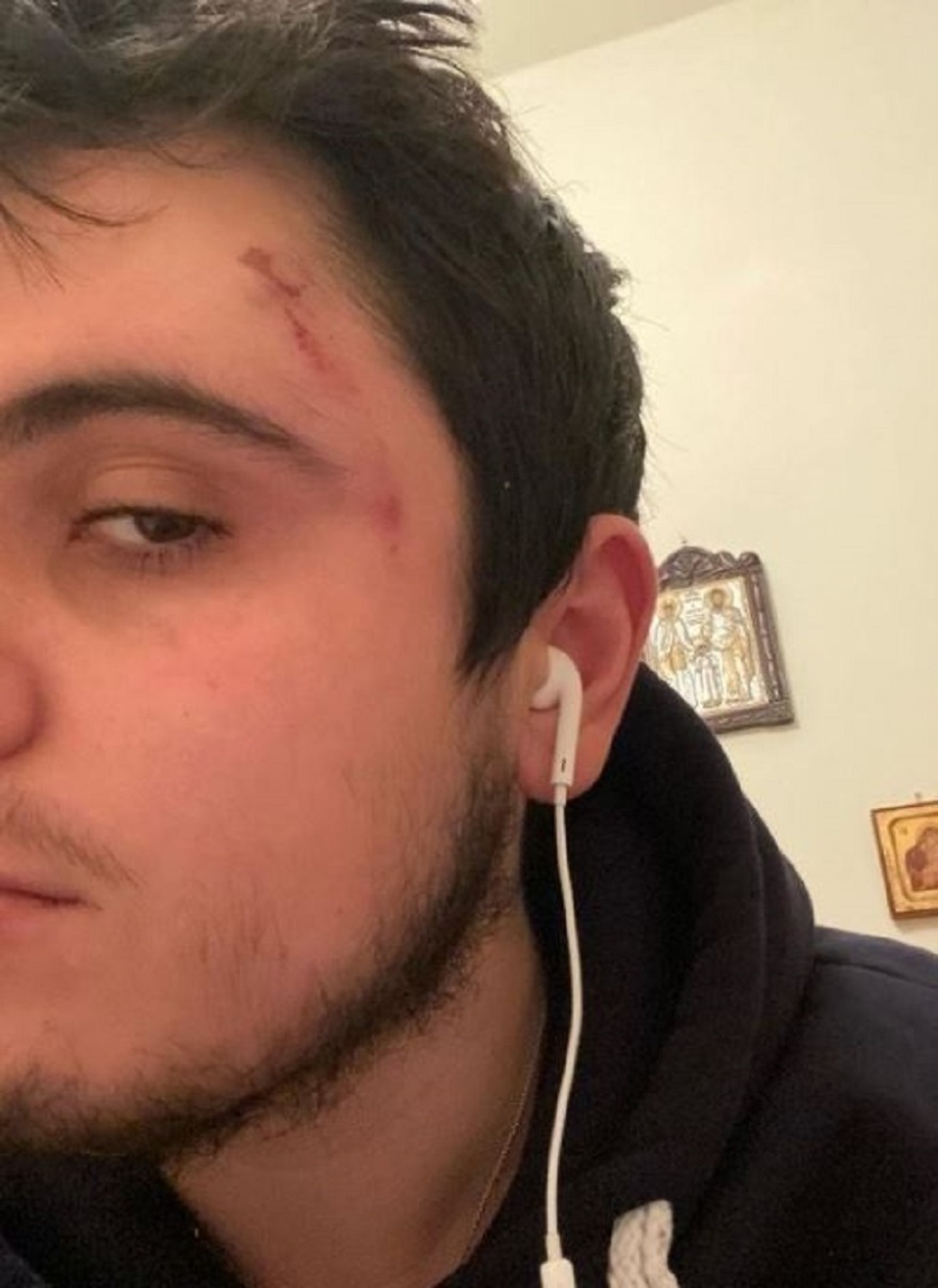 Οπαδική βία: Νέα καταγγελία στα Χανιά - «Αυτό που με χωρίζει από τον Άλκη, είναι η τύχη»