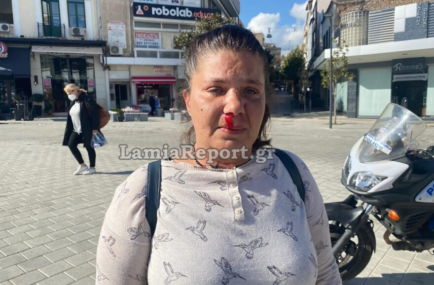 Επεισόδιο βίας κατά γυναίκας στη Λαμία: «Μου έριχνε μπουνιές στη μέση του δρόμου, φοβάμαι ότι θα με σκοτώσει»