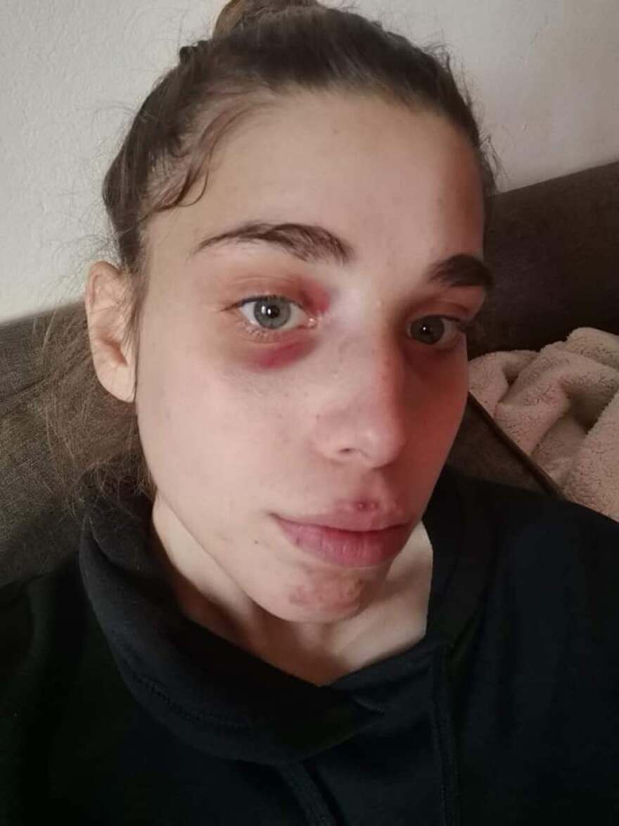 Εικοσάχρονη στην Κρήτη  έβγαλε νοκ-άουτ επίδοξο ληστή 