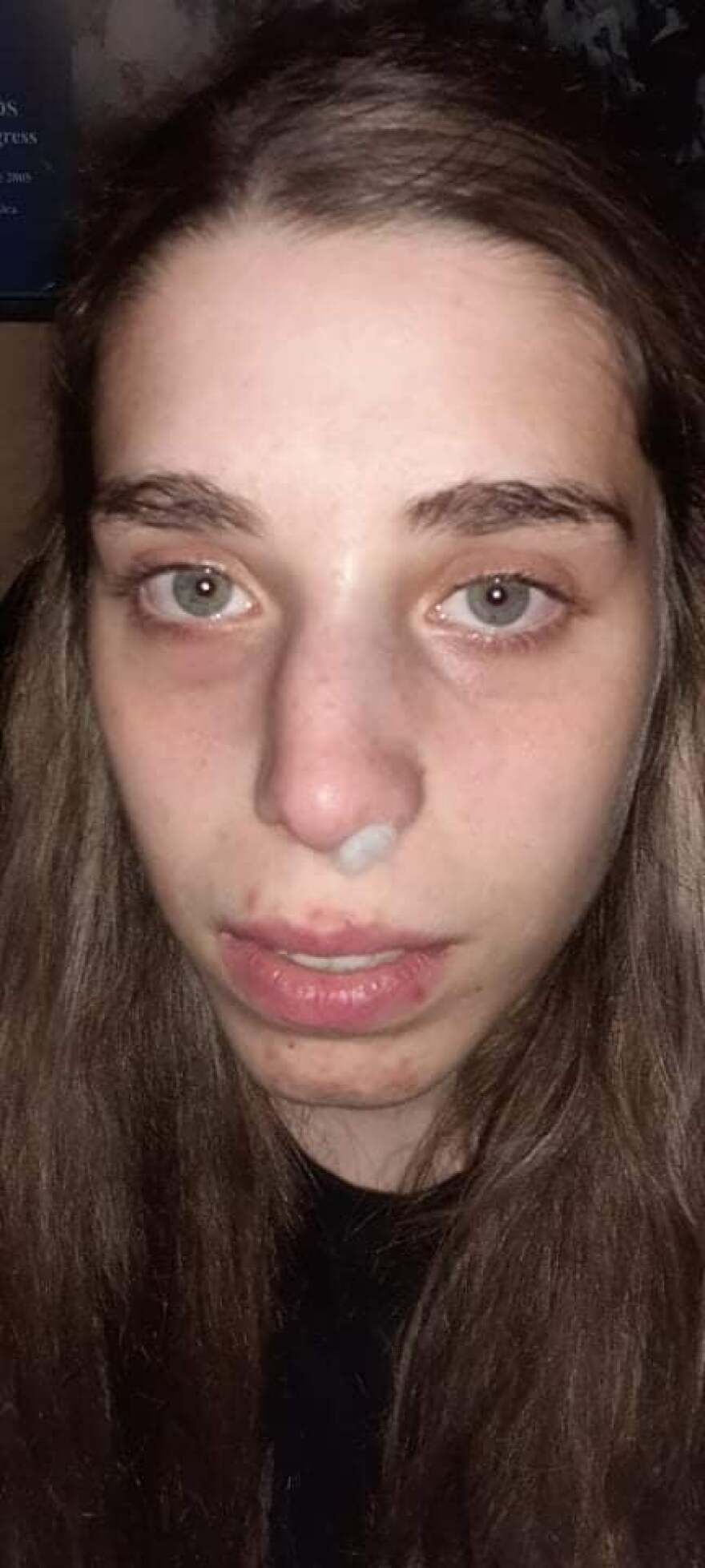 Εικοσάχρονη στην Κρήτη  έβγαλε νοκ-άουτ επίδοξο ληστή 