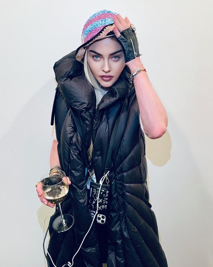 Μαντόνα: Η 63χρονη σταρ το «παράκανε» με τα φίλτρα του Instagram και μοιάζει σαν έφηβη