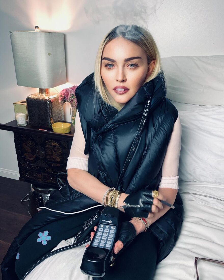 Μαντόνα: Η 63χρονη σταρ το «παράκανε» με τα φίλτρα του Instagram και μοιάζει σαν έφηβη