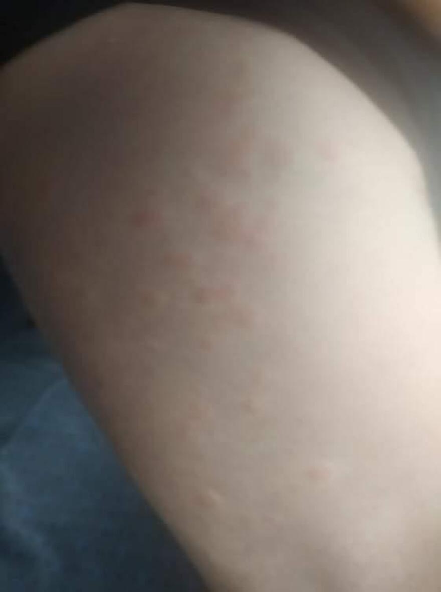 Euroferry Olympia: Τον «έφαγαν» οι ψύλλοι μέσα στο πλοίο - Δείτε φωτογραφίες