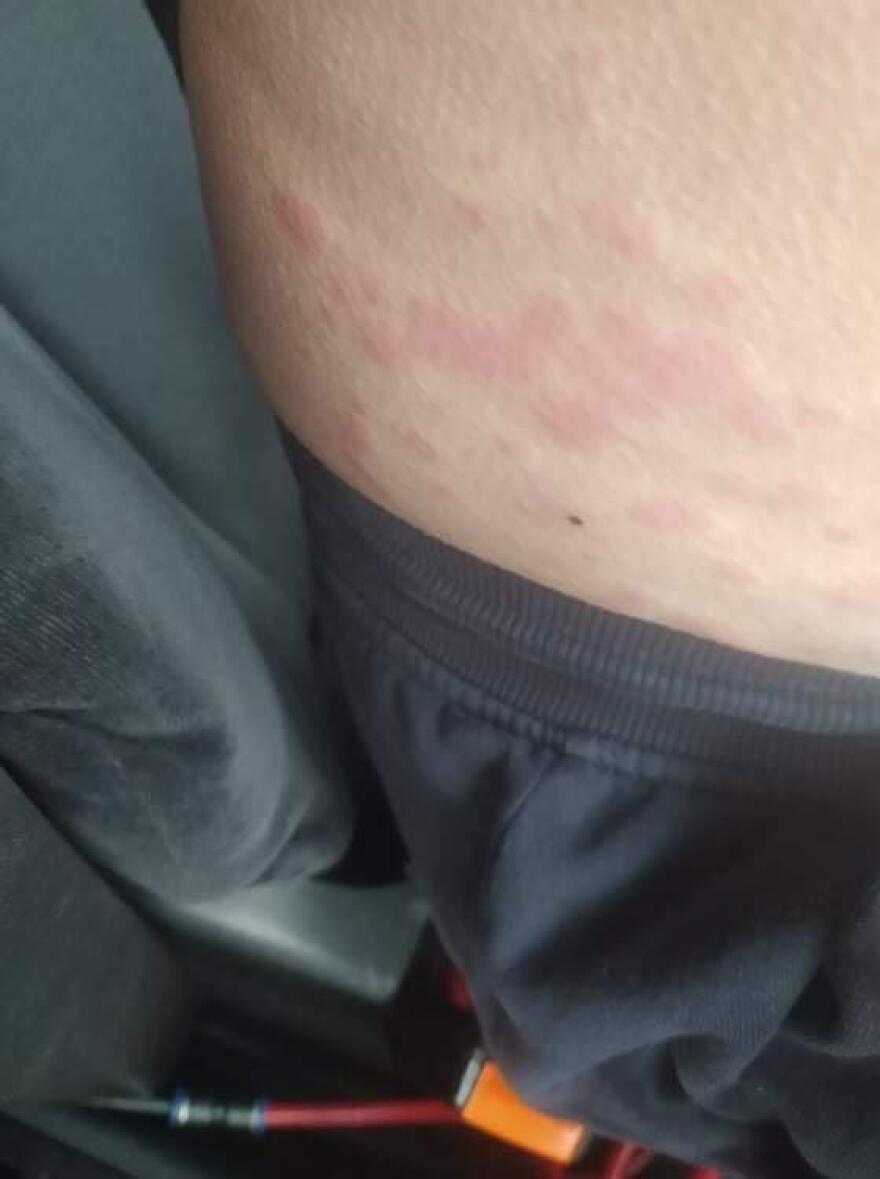 Euroferry Olympia: Τον «έφαγαν» οι ψύλλοι μέσα στο πλοίο - Δείτε φωτογραφίες