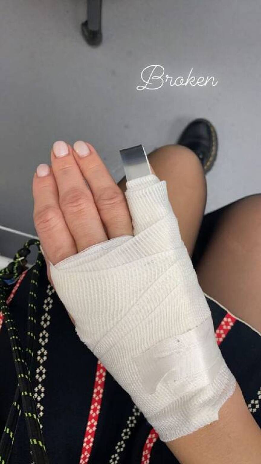 Κατερίνα Παπουτσάκη: Το ατύχημα που την έστειλε στο νοσοκομείο