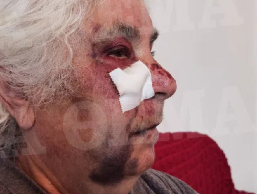 Ληστεία στο Αιγάλεω: Βίντεο-ντοκουμέντο δείχνει πώς εξαπάτησαν και κακοποίησαν την 80χρονη