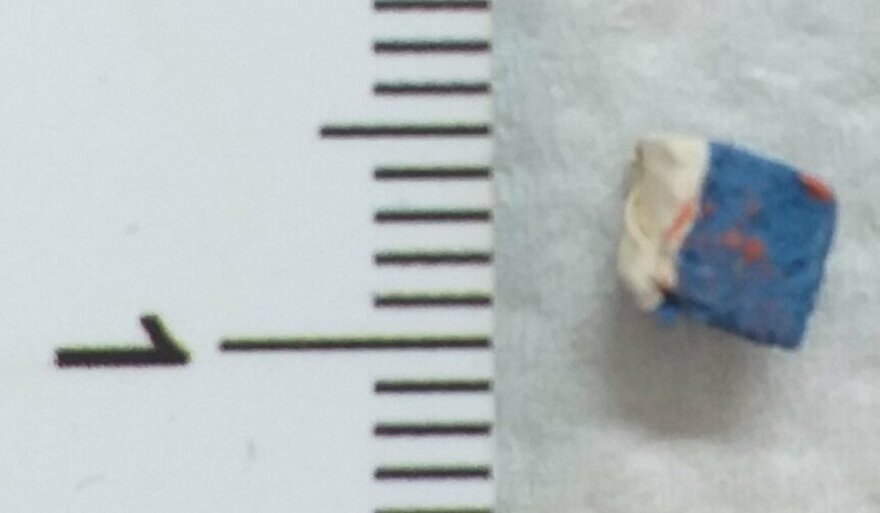 Θεσσαλονίκη: Κοριτσάκι 16 μηνών κατάπιε γόμα  - Το έσωσαν οι γιατροί στο «Ιπποκράτειο»