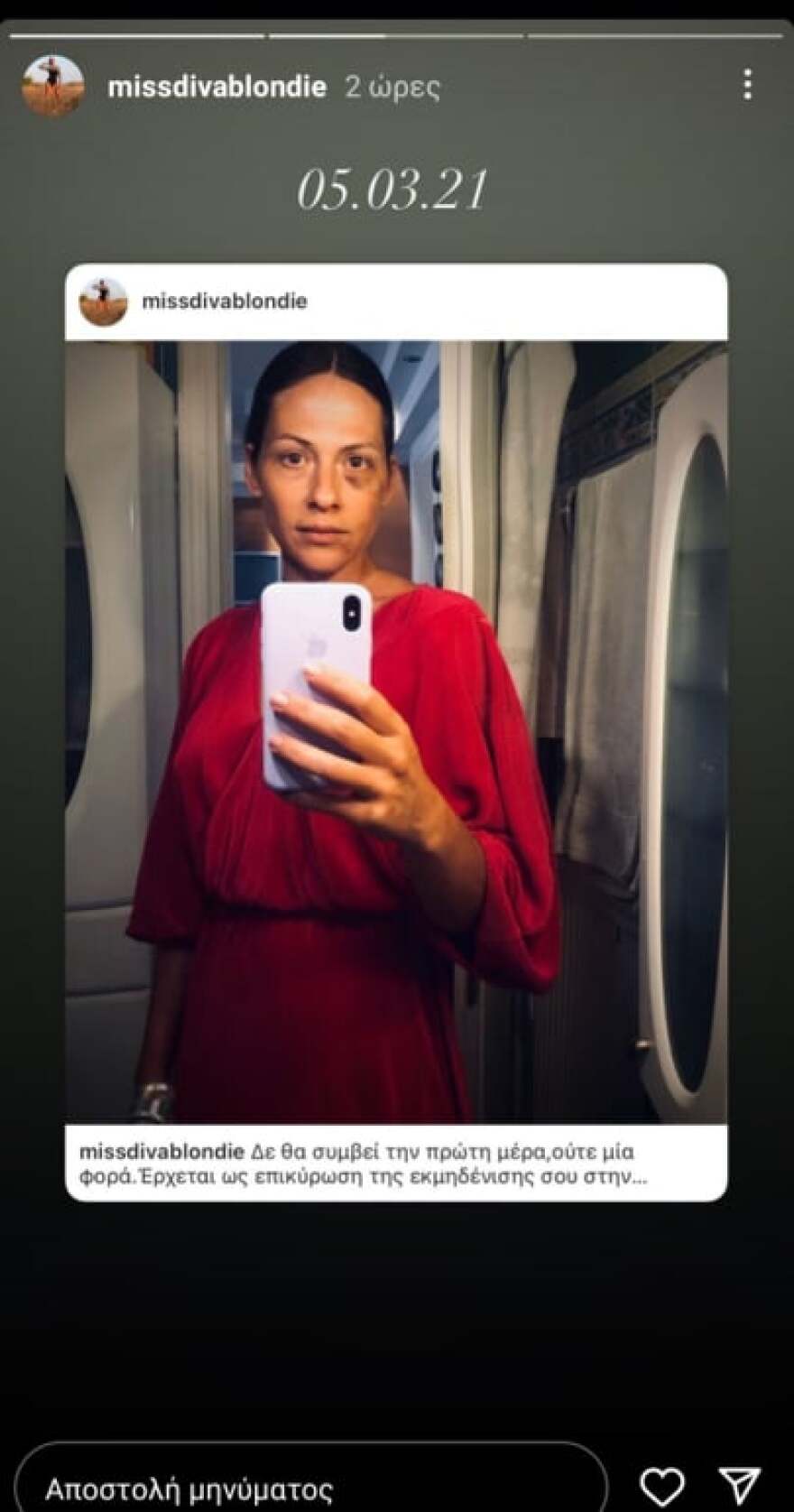 Μαρία Δεληθανάση: Η φωτογραφία από την ημέρα του ξυλοδαρμού της και το μήνυμα στήριξης σε όλα τα θύματα βίας