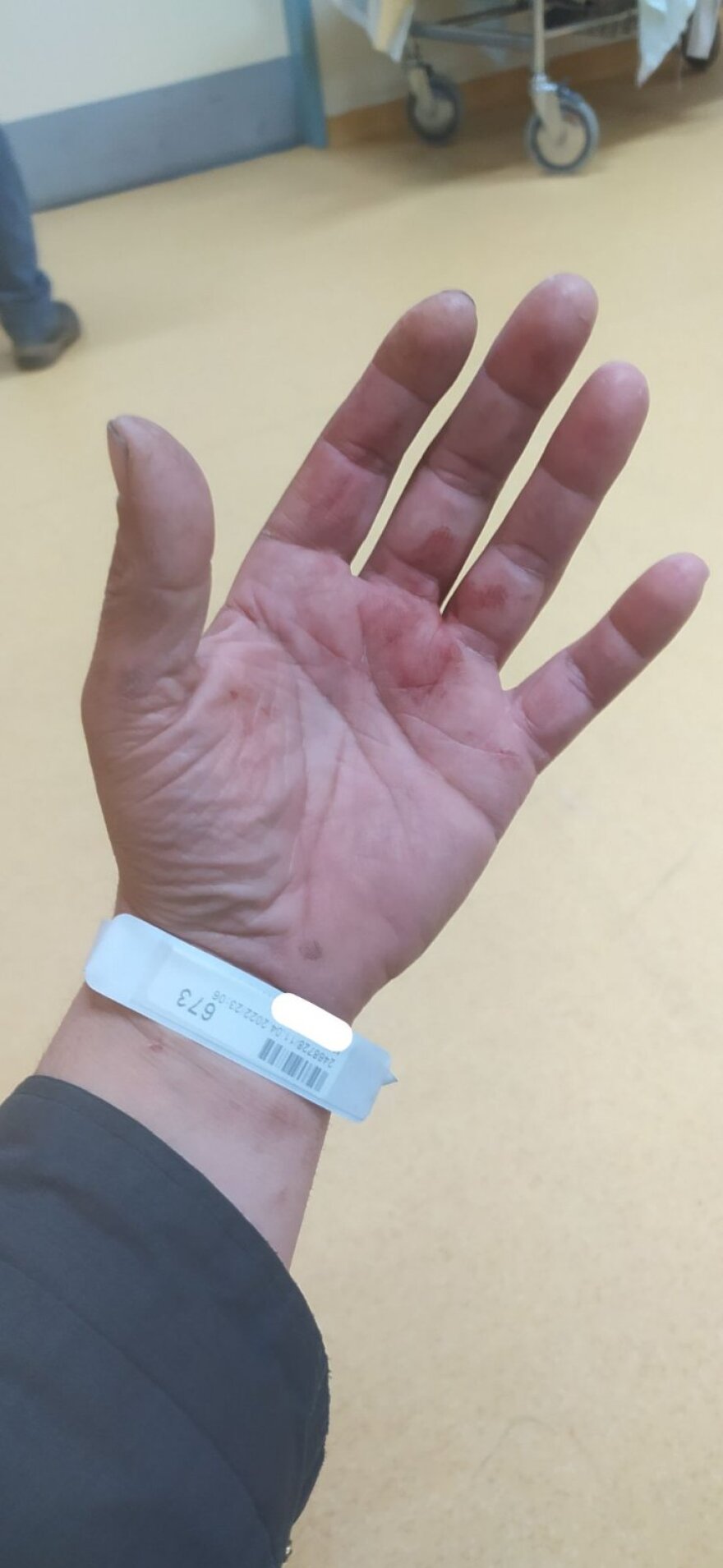 Θεσσαλονίκη: Επιβάτης χτύπησε άγρια οδηγό λεωφορείου - «Κινδύνευσε η σωματική μου ακεραιότητα»