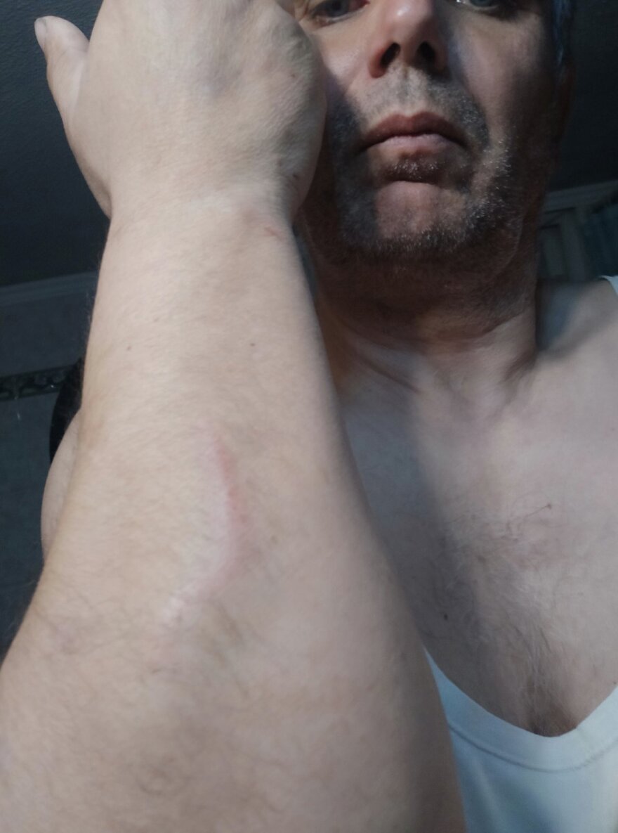 Θεσσαλονίκη: Επιβάτης χτύπησε άγρια οδηγό λεωφορείου - «Κινδύνευσε η σωματική μου ακεραιότητα»