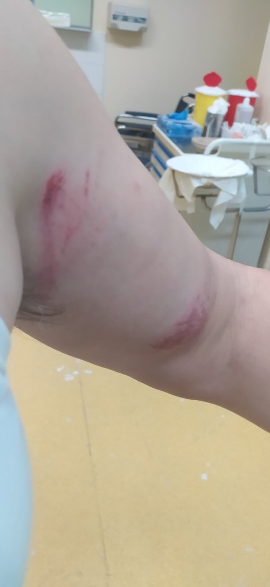 Θεσσαλονίκη: Επιβάτης χτύπησε άγρια οδηγό λεωφορείου - «Κινδύνευσε η σωματική μου ακεραιότητα»