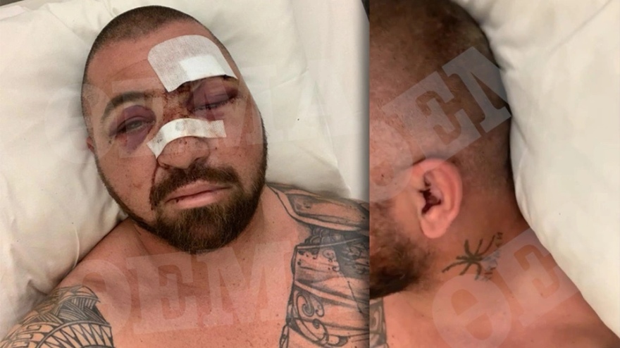 O Έλληνας bodyguard, o Ινδός δισεκατομμυριούχος και το άγριο ξύλο από 30 μεθυσμένους Γαλλομαροκινούς- Φωτογραφίες 