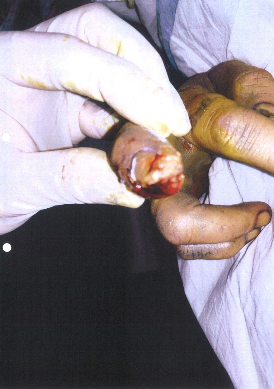 Αμπερ Χέρντ προς Τζόνι Ντεπ: «Απλά σε χτύπησα, μην κάνεις σαν μωρό!»