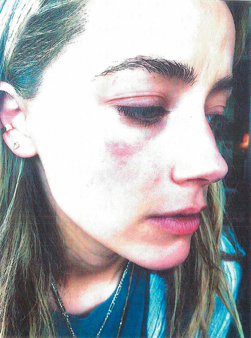 Τζόνι Ντεπ - Άμπερ Χερντ: Το «ξεκατίνιασμα» του αιώνα σε... έξι σκηνές