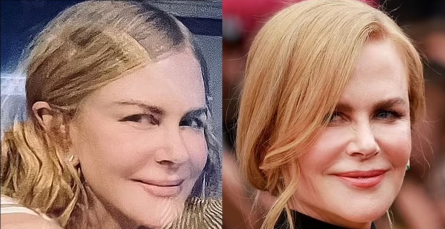 Νικόλ Κίντμαν: Αγνώριστη στο Instagram - Νέο σοκ για τους θαυμαστές της