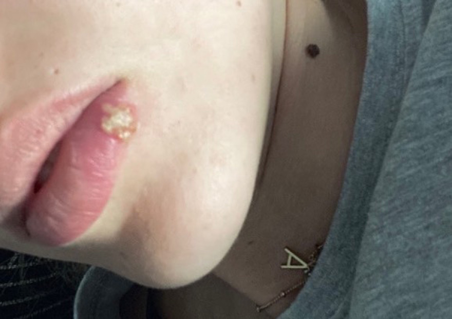 Κορακάκη: Συγκλονιστική ανάρτηση για τον stalker που της είχε κάνει τη ζωή κόλαση